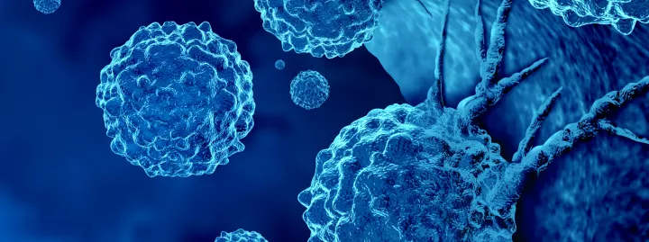 Μεταστατικός καρκίνος: Όταν δεν εντοπίζεται η αρχική εστία