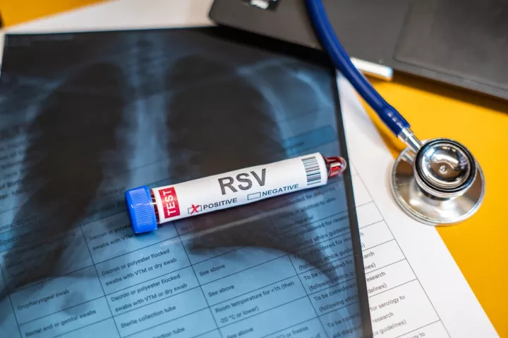 Λοίμωξη από RSV: Συμπτώματα και θεραπεία