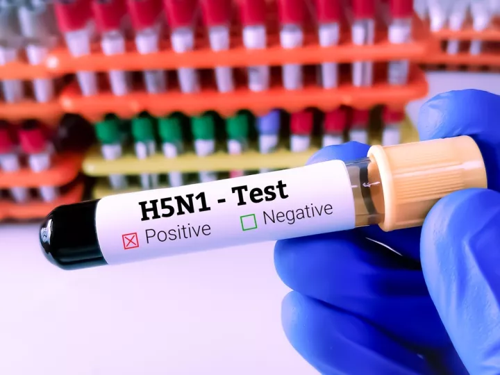 Πρώτο κρούσμα της γρίπης των πτηνών H5N1 στην Αυστραλία - Η κυβέρνηση θα κάνει ό,τι μπορεί, λέει ο Αλμπανέζι
