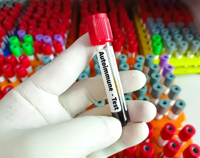 Metis TechBio: Συμφωνία έως 1,6 δισ. δολάρια για πειραματικό φάρμακο κατά αυτοάνοσων με «όπλο» την Τεχνητή Νοημοσύνη